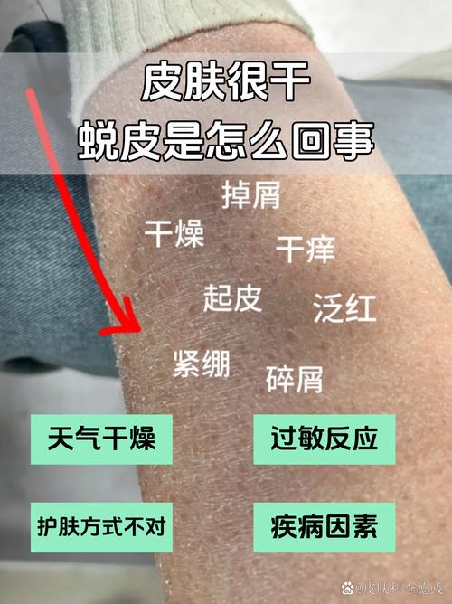 怀孕期间皮肤干燥脱皮,是激素变化还是缺水?该如何有效缓解?-第3张图片-郑州医学网 怀孕期间皮肤干燥脱皮,是激素变化还是缺水?该如何有效缓解?-第3张图片-郑州医学网