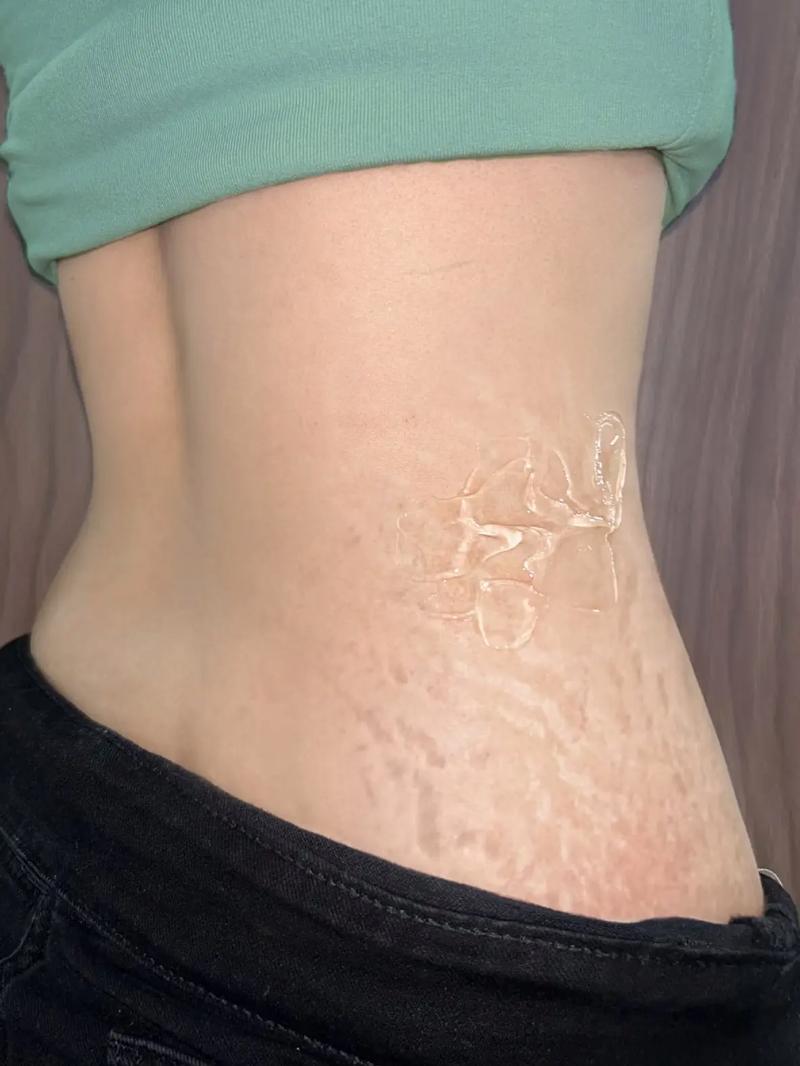 怀孕期间小腹韧带拉伤是怎么回事？该怎么缓解和预防？-第2张图片-郑州医学网