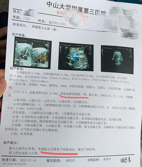 孕期必须做心脏彩超吗?哪些情况需要重点检查?对胎儿和孕妇有影响吗?-第1张图片-郑州医学网 孕期必须做心脏彩超吗?哪些情况需要重点检查?对胎儿和孕妇有影响吗?-第1张图片-郑州医学网