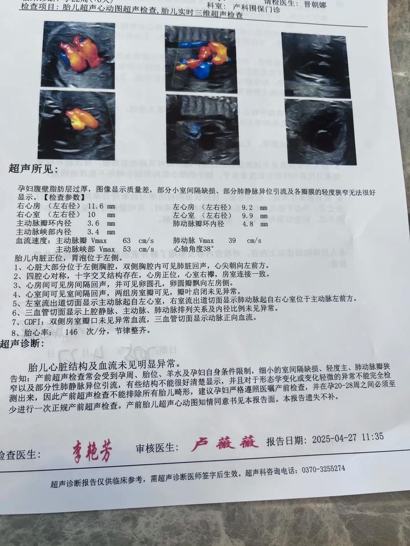 孕期必须做心脏彩超吗?哪些情况需要重点检查?对胎儿和孕妇有影响吗?-第2张图片-郑州医学网 孕期必须做心脏彩超吗?哪些情况需要重点检查?对胎儿和孕妇有影响吗?-第2张图片-郑州医学网