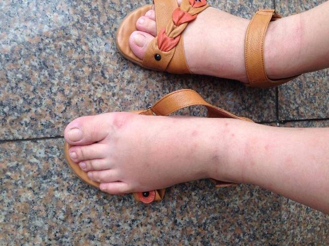 儿童肾功能异常有哪些容易被忽视的表现?家长该如何早期识别?-第1张图片-郑州医学网 儿童肾功能异常有哪些容易被忽视的表现?家长该如何早期识别?-第1张图片-郑州医学网