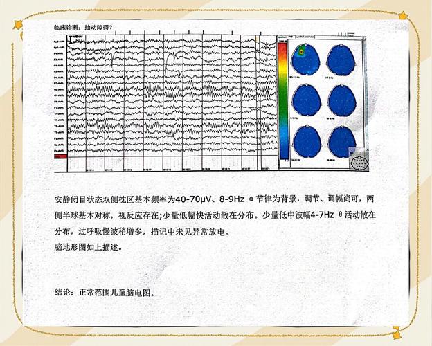新生儿做脑电图到底会不会影响大脑发育？安全吗？家长最该了解的这些事！-第3张图片-郑州医学网