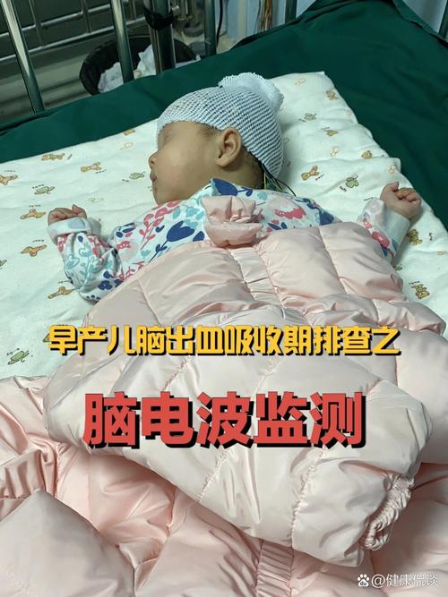 新生儿做脑电图到底会不会影响大脑发育？安全吗？家长最该了解的这些事！-第1张图片-郑州医学网