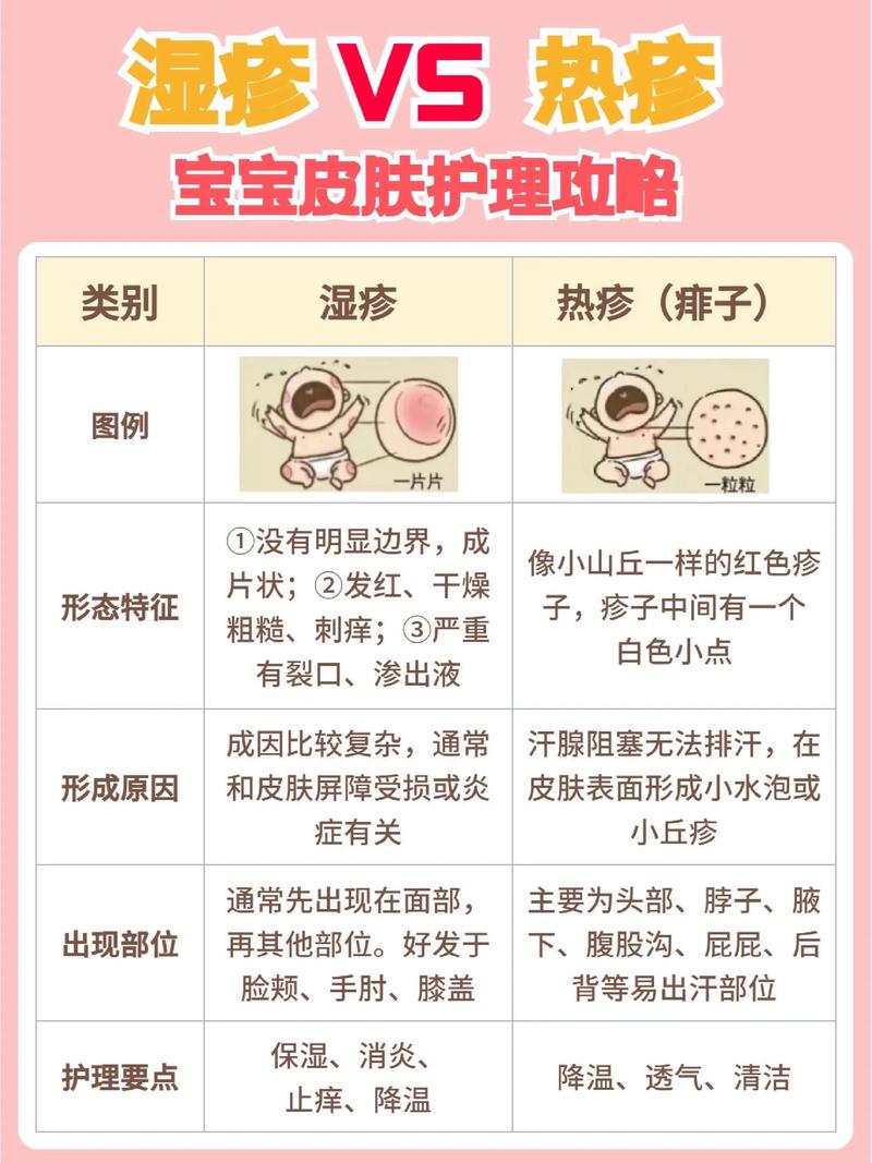 新生儿湿疹的神秘诱因，遗传、环境与免疫失衡如何共同作祟？-第2张图片-郑州医学网
