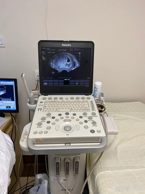 孕期超声波检查是什么？它如何保障母婴健康，又有哪些关键作用？-第2张图片-郑州医学网