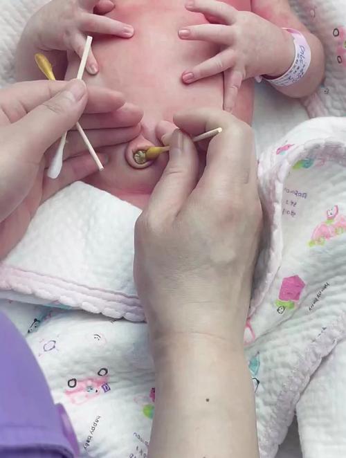 新生儿脐带护理视频,新手爸妈必看!如何正确护理避免感染?-第3张图片-郑州医学网 新生儿脐带护理视频,新手爸妈必看!如何正确护理避免感染?-第3张图片-郑州医学网