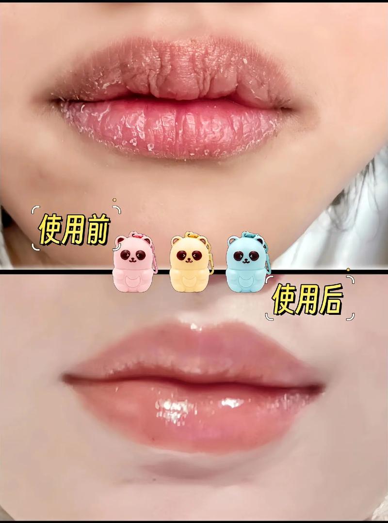 儿童嘴皮干裂是缺水还是生病了？家长该怎么正确处理和预防？-第3张图片-郑州医学网