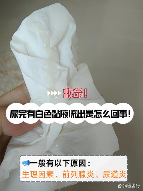 儿童尿液中出现白色液体是何原因？是否正常及需如何处理？-第2张图片-郑州医学网