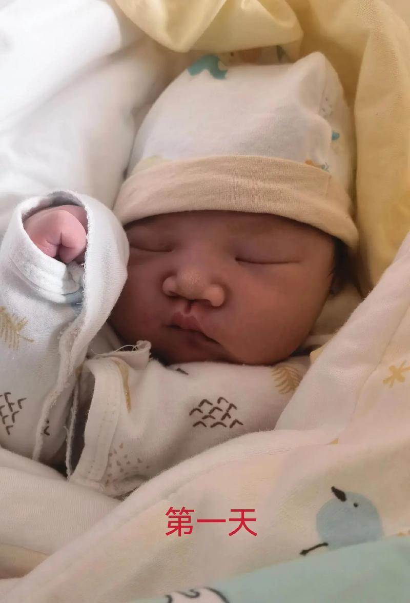 新生儿蛋蛋一个大一个小，是正常生理差异还是需要警惕的疾病信号？-第1张图片-郑州医学网