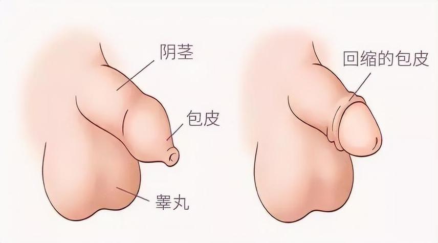 新生儿睾丸一边大一边小是正常现象吗？需要就医检查吗？-第3张图片-郑州医学网
