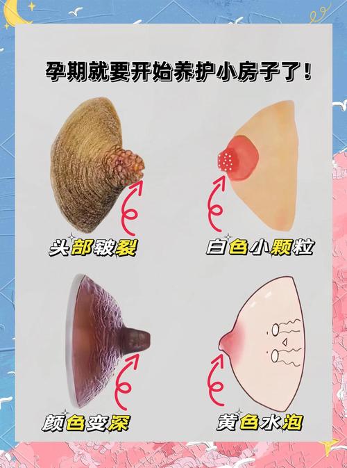 孕期用香皂洗乳房是否安全？会不会影响哺乳或皮肤健康？-第3张图片-郑州医学网