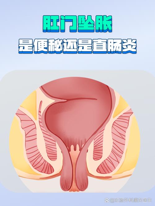孕期没便秘却肛门坠胀痛，是孕期特殊生理反应还是其他疾病信号？-第1张图片-郑州医学网