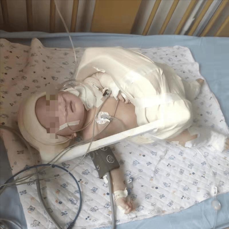 新生儿臂丛神经损伤有哪些典型症状?如何早期识别与干预?-第1张图片-郑州医学网 新生儿臂丛神经损伤有哪些典型症状?如何早期识别与干预?-第1张图片-郑州医学网