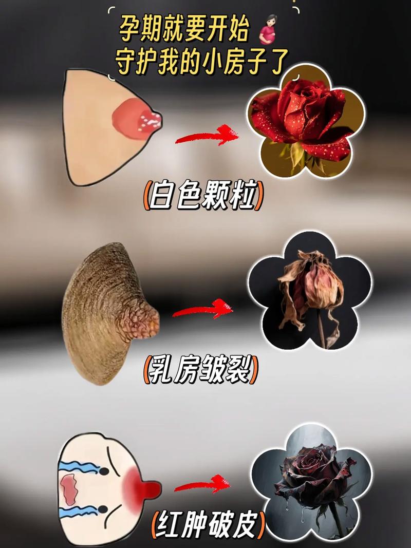 孕期乳晕发痒是正常生理反应还是疾病信号？需要干预吗？-第1张图片-郑州医学网