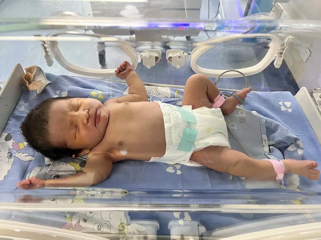 新生儿黄疸值多高必须住院？照光治疗期间家长要注意什么？-第1张图片-郑州医学网