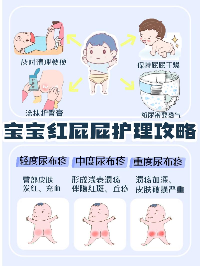 新生儿尿不湿过敏红肿哭闹，这3步护理能快速缓解吗？-第1张图片-郑州医学网