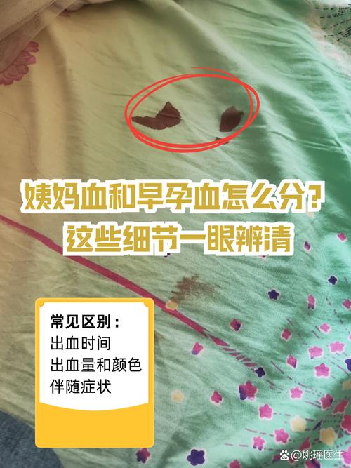 孕期月经出血是正常生理现象还是异常信号？需警惕哪些潜在风险？-第3张图片-郑州医学网