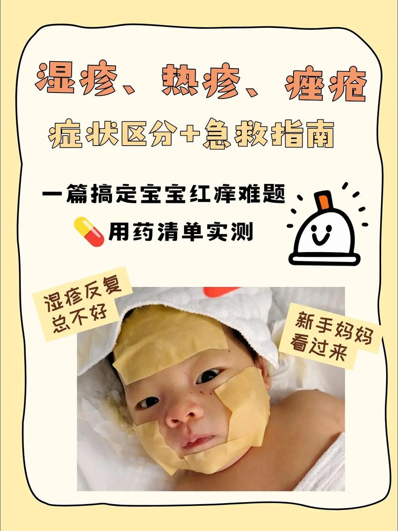新生儿脸上湿疹反复发作，日常护理该注意哪些细节才能有效缓解？-第1张图片-郑州医学网