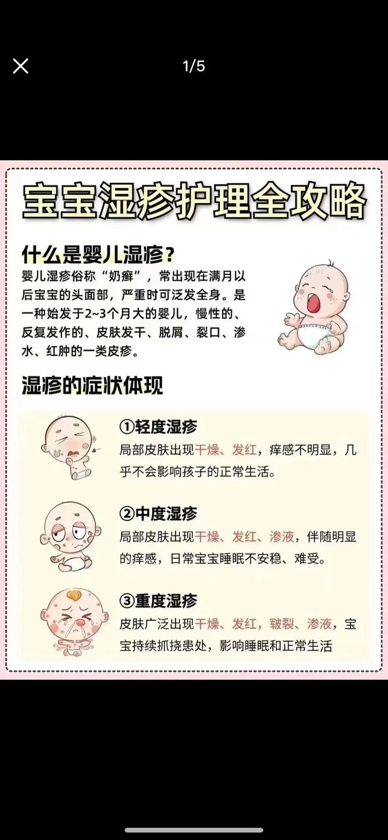 新生儿宝宝湿疹怎么护理-第2张图片-郑州医学网