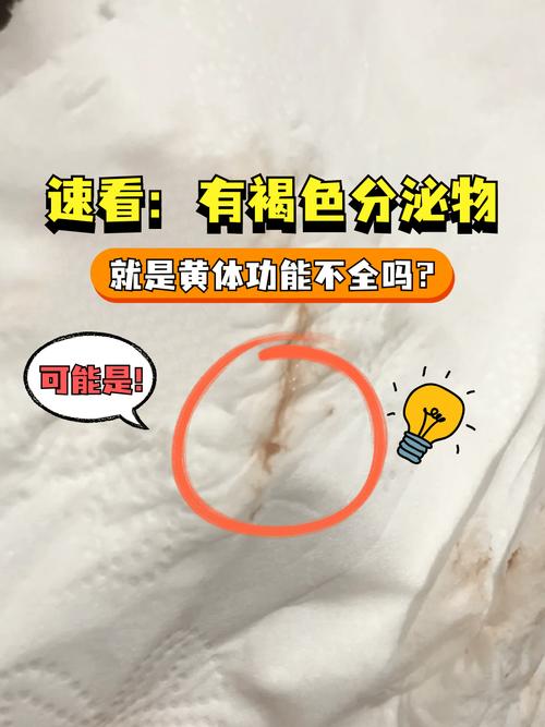 孕期白带有褐色丝状物是先兆流产信号还是妇科炎症？-第2张图片-郑州医学网