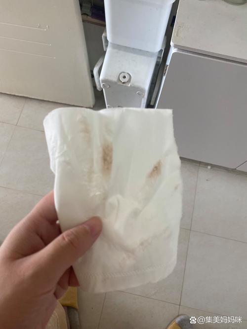 孕期白带有褐色丝状物是先兆流产信号还是妇科炎症？-第3张图片-郑州医学网