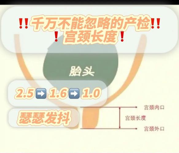 孕期宫颈管分离到底意味着什么？会对宝宝有影响吗？需要怎么处理？-第3张图片-郑州医学网