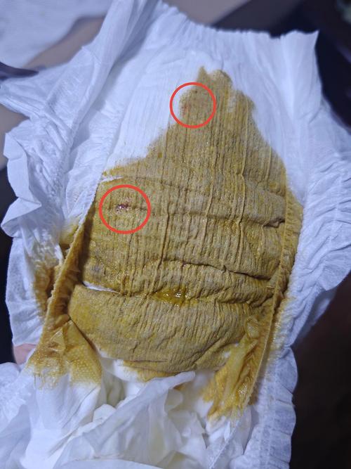 新生儿血液粘稠到底有没有危险？会对宝宝健康造成哪些影响？-第2张图片-郑州医学网