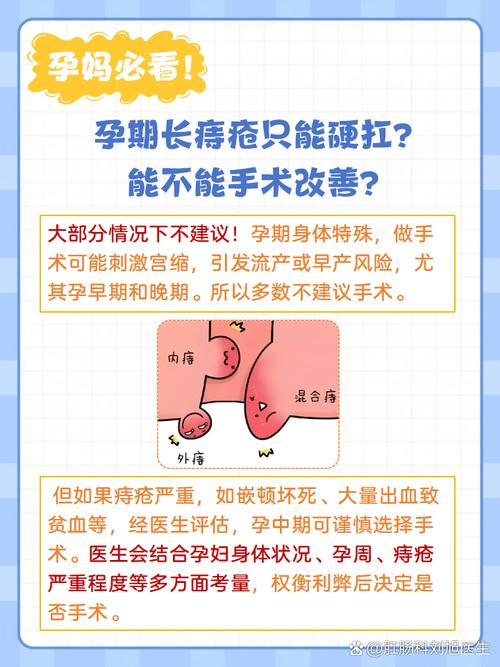 孕期痔疮高发，究竟是什么原因在悄悄作祟？-第3张图片-郑州医学网