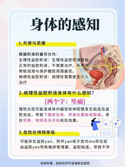 孕期盆腔积液会自行排出吗？对胎儿有影响吗？需要治疗吗？-第2张图片-郑州医学网