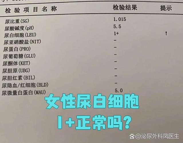 孕期尿检白细胞一百多严重吗？对胎儿有影响吗？需要怎么治疗？-第1张图片-郑州医学网