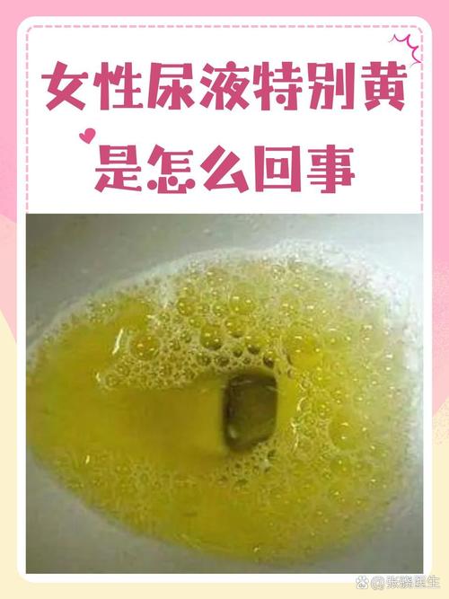 孕期小便混浊是女孩吗？这种说法有科学依据吗？-第2张图片-郑州医学网