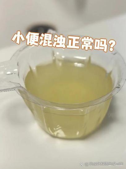 孕期小便混浊是女孩吗？这种说法有科学依据吗？-第1张图片-郑州医学网