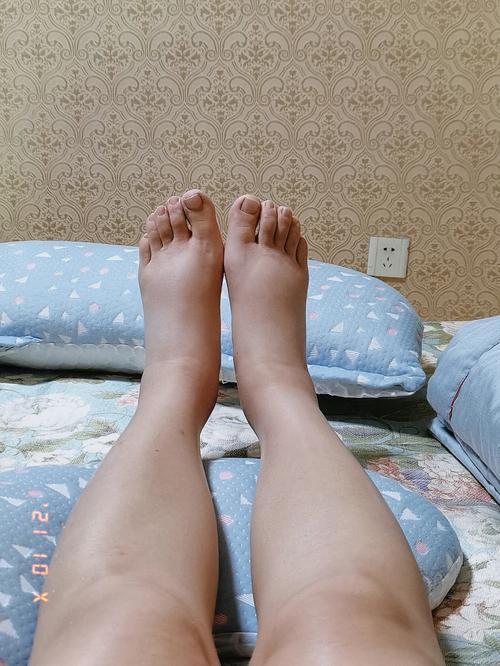 孕期28周出现水肿是正常的生理现象吗？需要担心吗？-第2张图片-郑州医学网