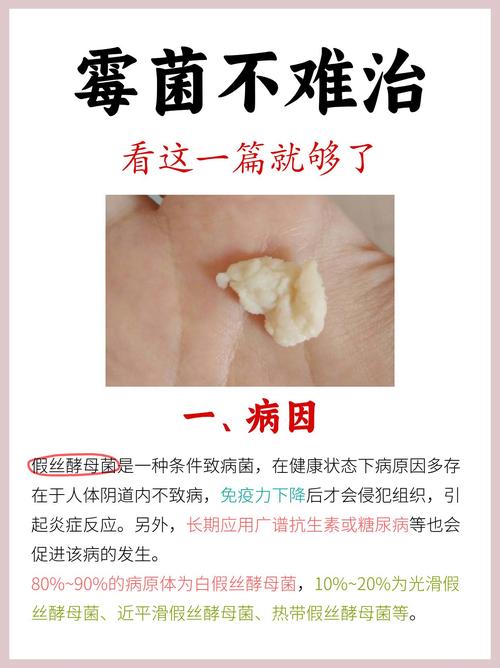 孕期感染霉菌与胎儿性别是否存在科学关联?-第2张图片-郑州医学网 孕期感染霉菌与胎儿性别是否存在科学关联?-第2张图片-郑州医学网