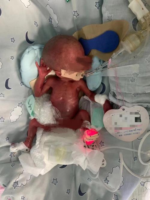 孕期80天胎儿图片能清晰看到哪些发育特征？这时的宝宝到底是什么样子的？-第3张图片-郑州医学网