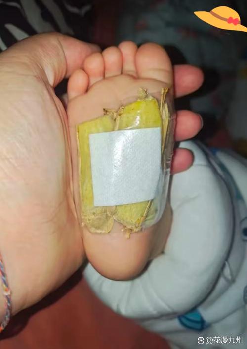 青岛儿童医院涌泉散，专治儿童哪些常见病，疗效如何？-第2张图片-郑州医学网