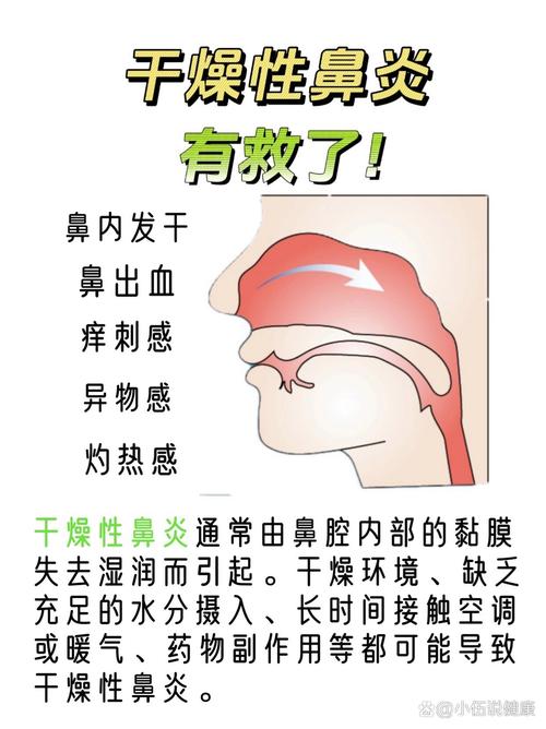孕期嗓子干鼻子不通气，是上火还是孕期鼻炎作祟？该如何缓解不适？-第2张图片-郑州医学网