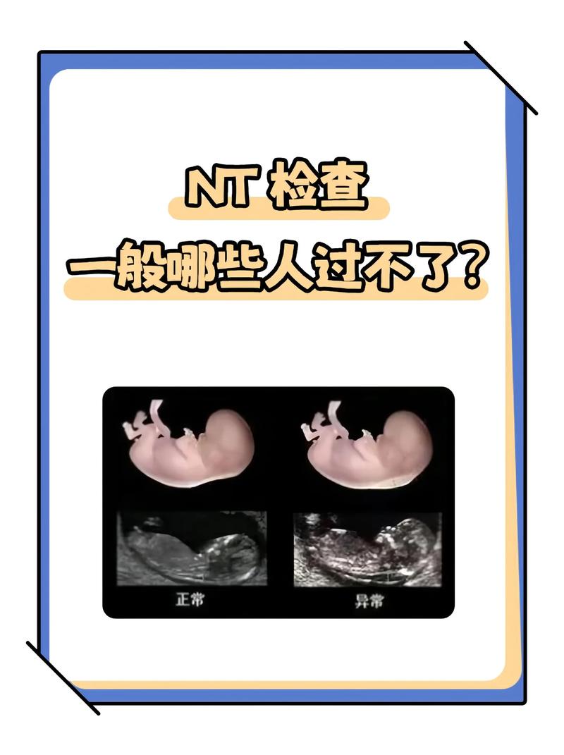 孕期彩超究竟能检查出哪些关键问题？胎儿健康与发育情况全解析！-第1张图片-郑州医学网