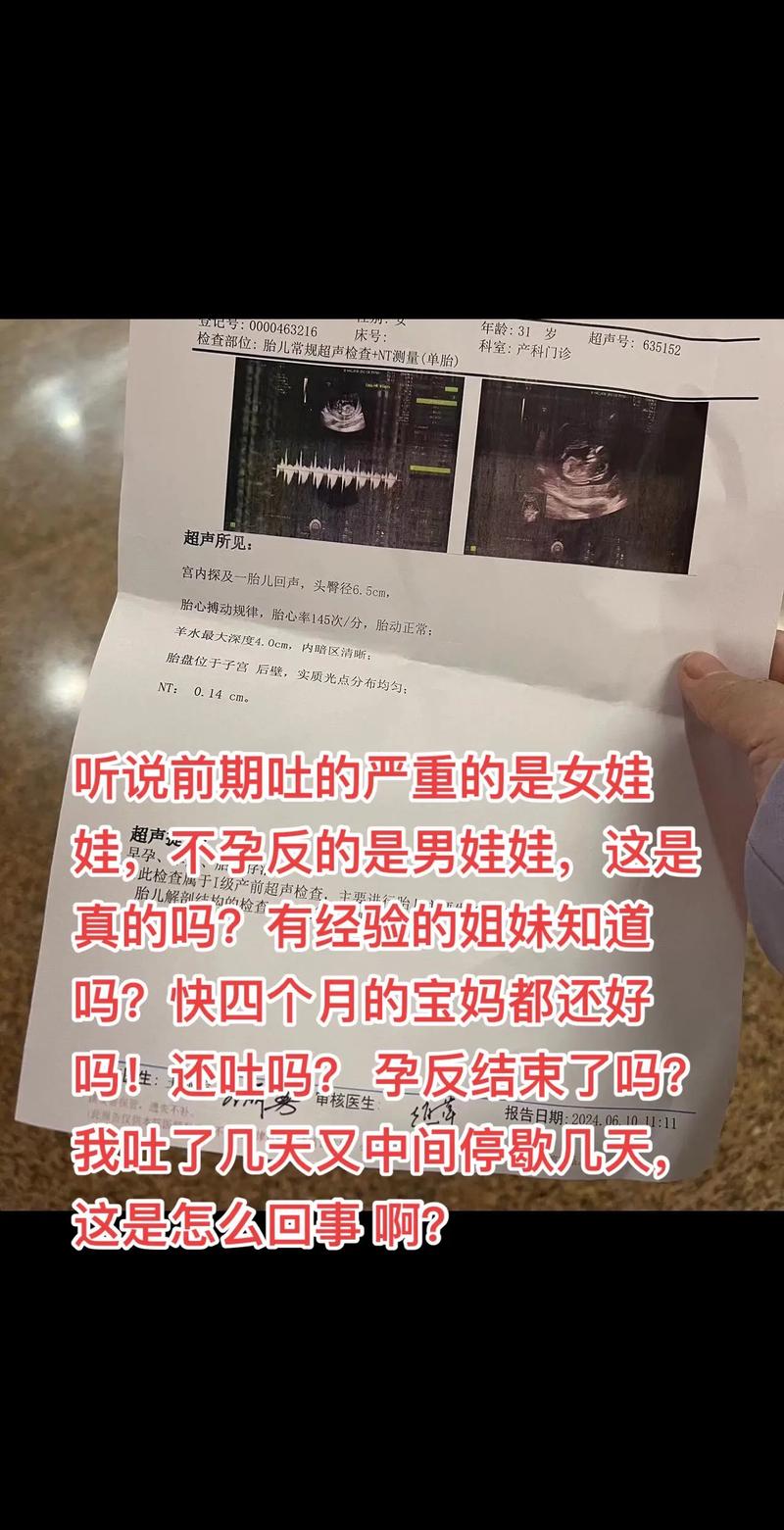 孕期晚上吐得厉害，这反应真能看出胎儿性别吗？-第1张图片-郑州医学网