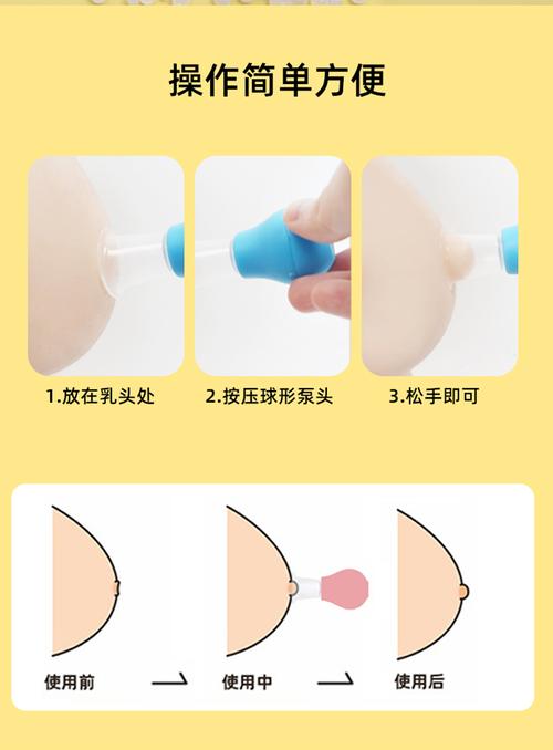 孕期乳头内陷能通过吸乳器改善吗？吸乳会对胎儿有影响吗？-第2张图片-郑州医学网