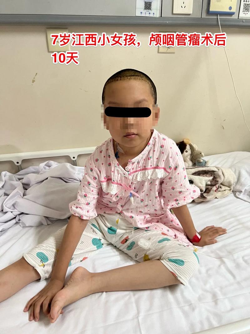 新生儿脑水肿的临床表现有哪些典型症状与早期识别要点？-第2张图片-郑州医学网