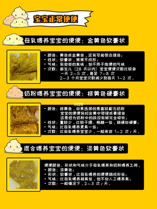 新生儿人工喂养大便次数多少算正常？不同阶段大便性状差异大吗？-第2张图片-郑州医学网