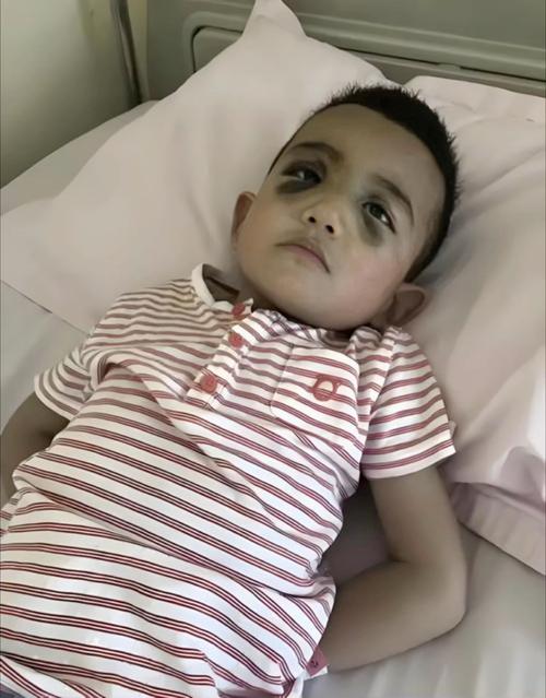 儿童铅超标对健康到底有哪些不可逆的伤害？家长该如何科学应对？-第2张图片-郑州医学网