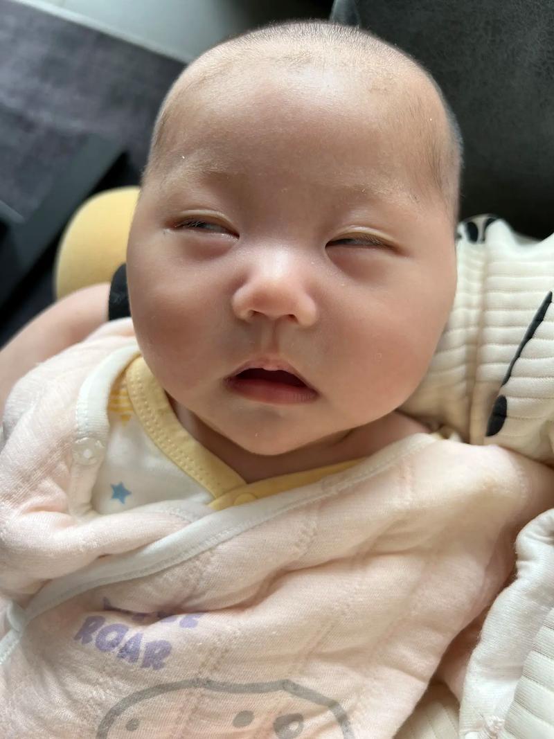 新生儿睡觉时翻白眼是正常现象还是健康预警?-第1张图片-郑州医学网 新生儿睡觉时翻白眼是正常现象还是健康预警?-第1张图片-郑州医学网