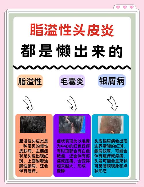 孕期患头癣，用药安全与胎儿健康如何兼顾？-第1张图片-郑州医学网