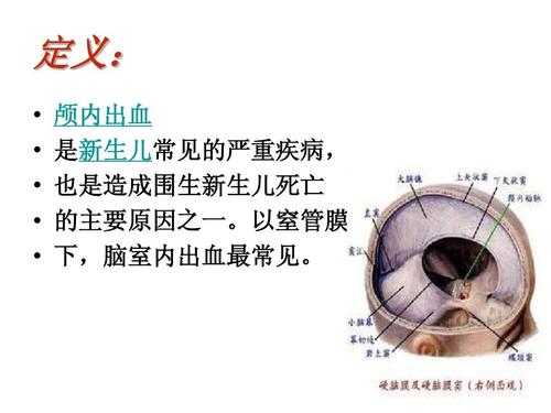新生儿颅内出血陈旧性，为何难以早期发现？如何干预预后？-第2张图片-郑州医学网