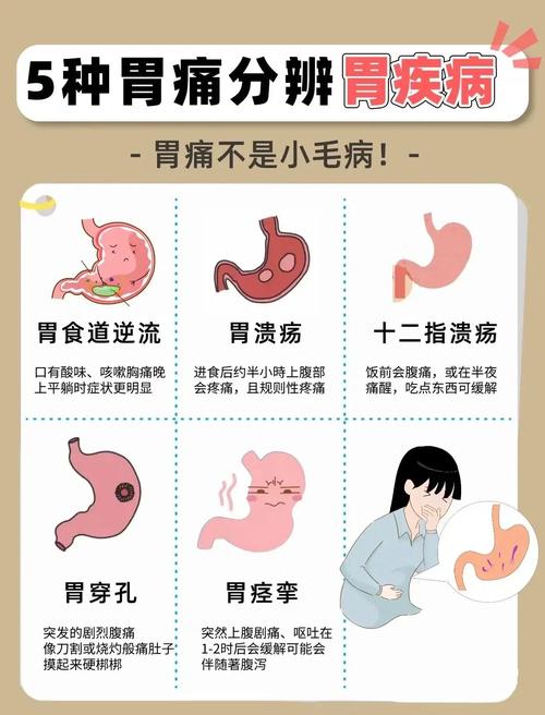 孕期胃炎的症状有哪些？会对胎儿造成影响吗？-第1张图片-郑州医学网