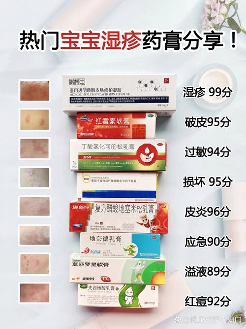 新生儿湿疹膏到底能不能用？用错会不会伤害娇嫩肌肤？-第1张图片-郑州医学网