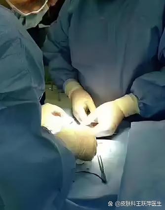 儿童做包皮手术为何必须全麻？家长该如何权衡风险与必要性？-第2张图片-郑州医学网