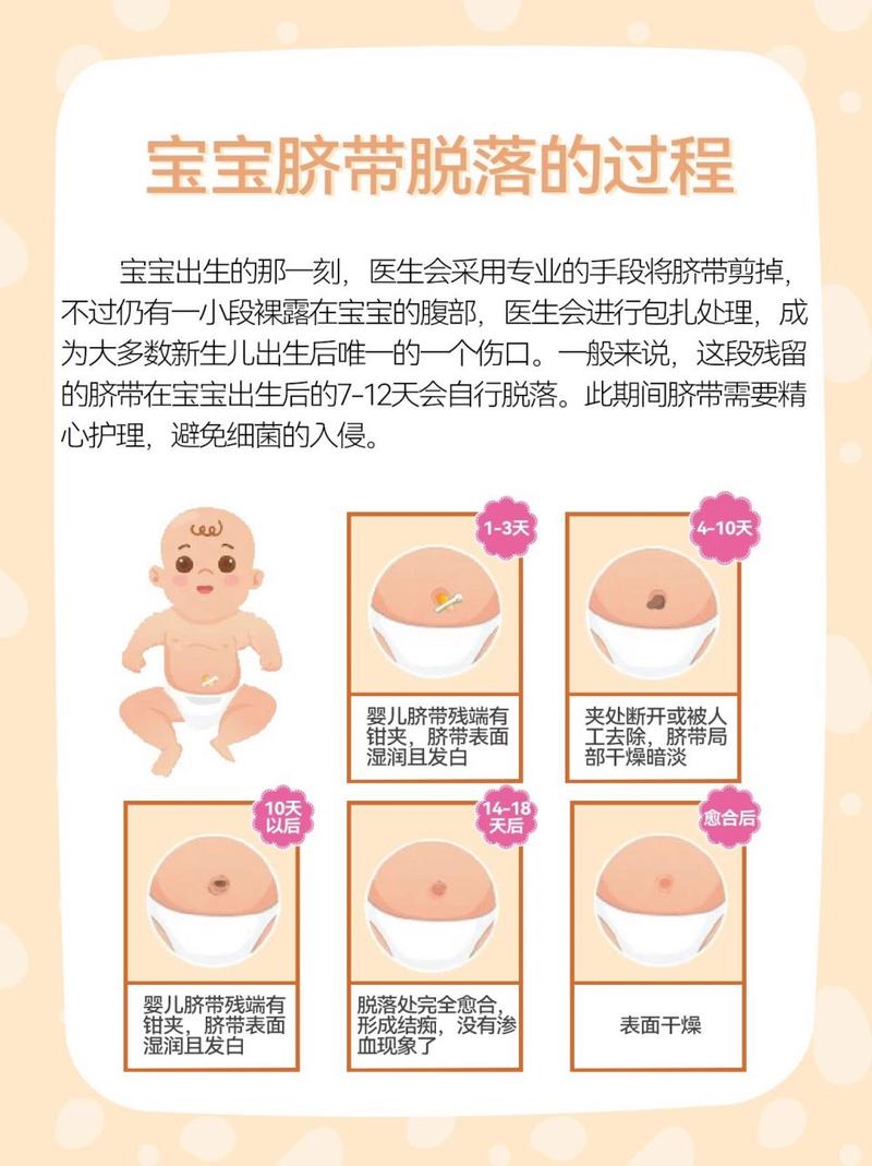新生儿脐带脱落需要多长时间？脱落前后家长该如何正确护理？-第3张图片-郑州医学网